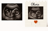 Customized Ultrasound Building Brick Set